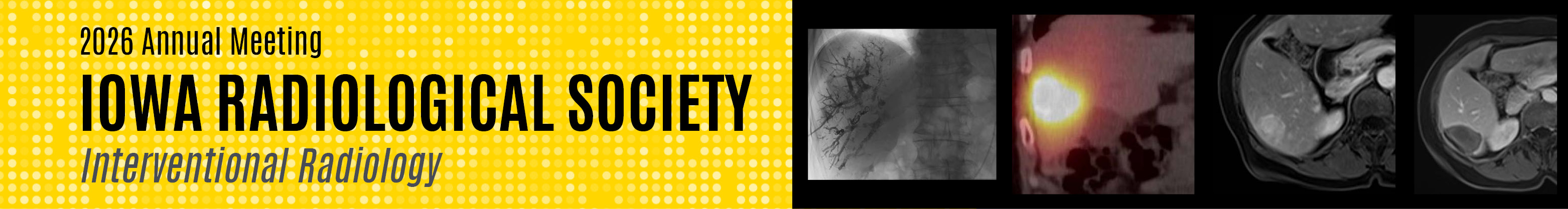 Iowa Radiological Society 2026 Annual Meeting: Interventional Radiology Banner